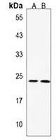 MMAB Rabbit Polyclonal Antibody