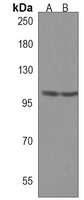 MORC3 Rabbit Polyclonal Antibody