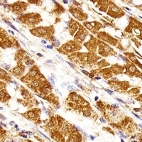 MORC3 Rabbit Polyclonal Antibody