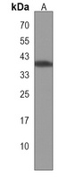 LMAN2L Rabbit Polyclonal Antibody