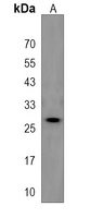 PIH1D3 Rabbit Polyclonal Antibody