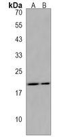 ZNF740 Rabbit Polyclonal Antibody