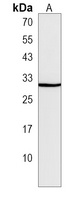 SIKE1 Rabbit Polyclonal Antibody