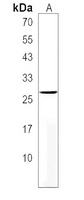 IPP2 Rabbit Polyclonal Antibody