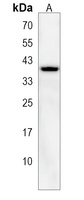 RALYL Rabbit Polyclonal Antibody