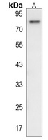 FCHSD2 Rabbit Polyclonal Antibody