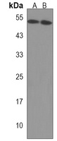 PCOLCE2 Rabbit Polyclonal Antibody
