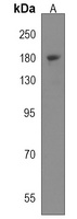 SYNJ2 Rabbit Polyclonal Antibody