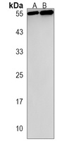 TBX4 Rabbit Polyclonal Antibody