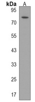 HECTD2 Antibody