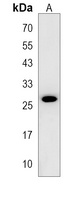 CIDEC Rabbit Polyclonal Antibody