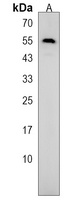 EEPD1 Rabbit Polyclonal Antibody