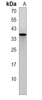 MND1 Rabbit Polyclonal Antibody
