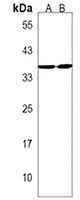 RQCD1 Antibody