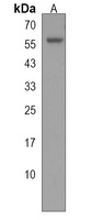 MBOAT2 Rabbit Polyclonal Antibody