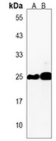 HMGB4 Rabbit Polyclonal Antibody