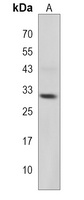 MPZL2 Rabbit Polyclonal Antibody