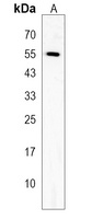 FBXW9 Rabbit Polyclonal Antibody