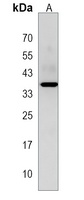 PBLD Rabbit Polyclonal Antibody