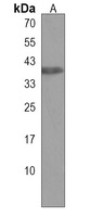 SYAP1 Rabbit Polyclonal Antibody