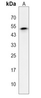 P2Y6 Rabbit Polyclonal Antibody