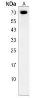 ASB3 Rabbit Polyclonal Antibody