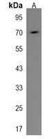 ARHGEF6 Rabbit Polyclonal Antibody
