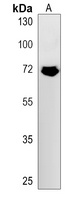 FNBP1L Rabbit Polyclonal Antibody