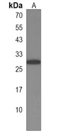 NKIRAS2 Antibody