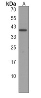 RBMS2 Rabbit Polyclonal Antibody