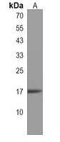 CHCHD10 Rabbit Polyclonal Antibody