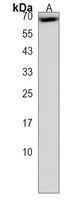 CLPTM1L Rabbit Polyclonal Antibody
