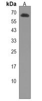 ARHGAP36 Rabbit Polyclonal Antibody