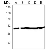 KRT28 Rabbit Polyclonal Antibody