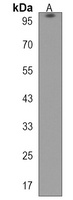TAX1BP1 Antibody