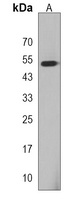 PBX2 Rabbit Polyclonal Antibody