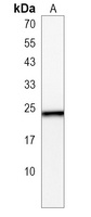 HPCA Rabbit Polyclonal Antibody