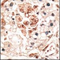 HPCA Rabbit Polyclonal Antibody
