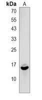 EIF1B Rabbit Polyclonal Antibody