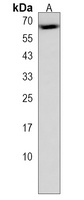 NR1D2 Rabbit Polyclonal Antibody