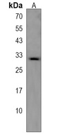 TRA2B Rabbit Polyclonal Antibody