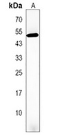 HOXD3 Rabbit Polyclonal Antibody