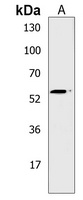 PRAK Rabbit Polyclonal Antibody