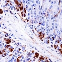 PRAK Rabbit Polyclonal Antibody