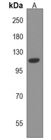 USP43 Rabbit Polyclonal Antibody