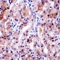 USP43 Rabbit Polyclonal Antibody