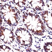 PDIA4 Rabbit Polyclonal Antibody