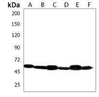 PDCD4 Rabbit Polyclonal Antibody