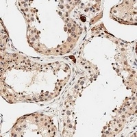 PDCD4 Rabbit Polyclonal Antibody