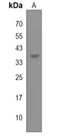 DPAGT1 Rabbit Polyclonal Antibody